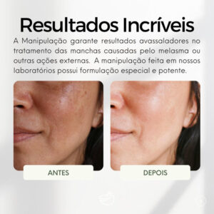 Creme Nova Pele Facial Clareador Melasma 25g
