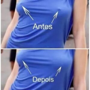 kit 100 Tapa-Seios Invisível Adesivo Protetor com 7,5cm de Diâmetro para Tampar Mamilos/Aureola/5PARElS 2024