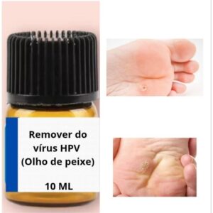 solução Magic calos( olho de peixe) esporão, unheira 10 ml