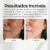 Creme Nova Pele Facial Clareador Melasma 25g